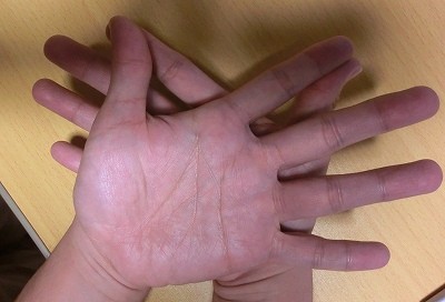 蟹の手